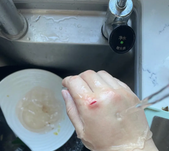 Người nghèo chấp niệm 7 thứ 