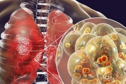 Liên tiếp nhập viện vì viêm phổi khi trời lạnh: Dấu hiệu cảnh báo bệnh, người cao tuổi tuyệt đối không bỏ qua