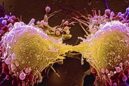 Món ăn thơm ngon khoái khẩu ngày lạnh nhưng tiềm ẩn tế bào ung thư, người Việt nên biết để tránh