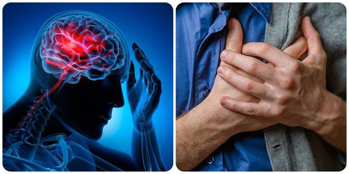 Đột quỵ ban đêm tăng mạnh, bác sĩ cảnh báo: Dù ở độ tuổi nào, trước khi ngủ cũng cần nhớ 5 không 3 Đột quỵ ban đêm tăng mạnh, bác sĩ cảnh báo: Dù ở độ tuổi nào, trước khi ngủ cũng cần nhớ '5 không' - 2