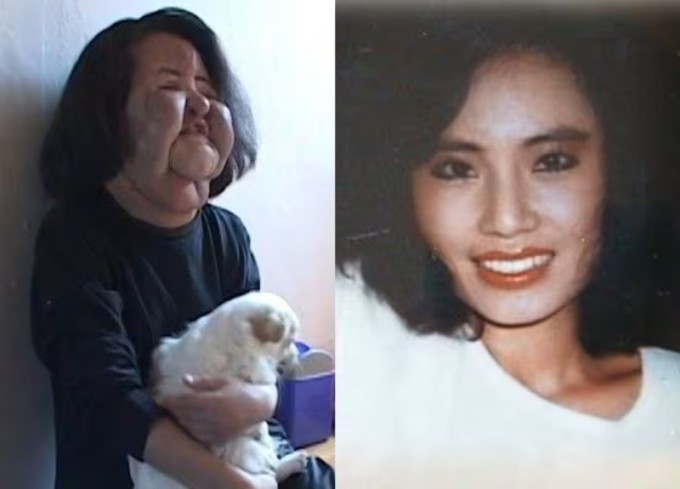 Han Hye Kyung trong giai đoạn khủng hoảng nhất (trái). Ảnh: Nate