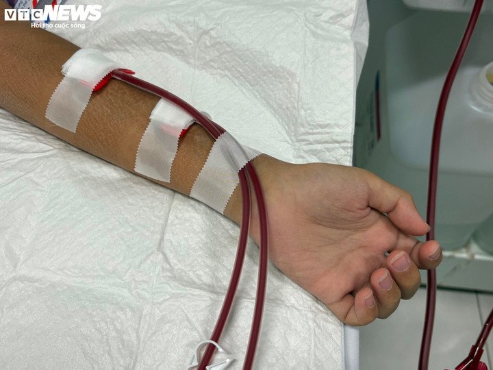 Phát hiện muộn suy thận mạn, nhiều trẻ sống phụ thuộc vào máy lọc máu 3 Chạy thận lâu dài có thể khiến trẻ gặp nhiều biến chứng.