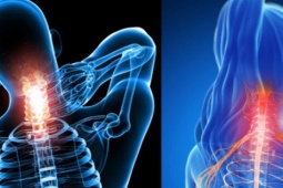 Bé 15 tuổi ở Hòa Bình đột ngột đau dữ dội, liệt tứ chi thừa nhận làm việc này trong lúc chơi game