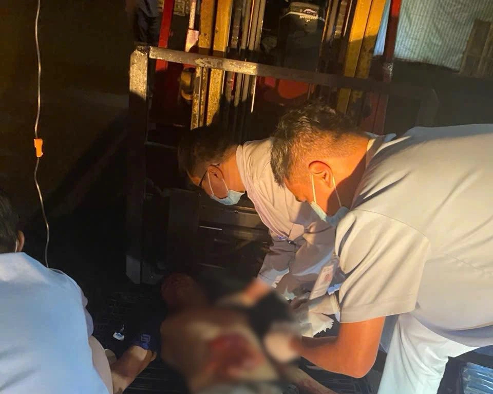 TP.HCM: Bị máy xay thịt 'nuốt chửng' tay, phải đưa cả người và máy vào phòng mổ- Ảnh 2.