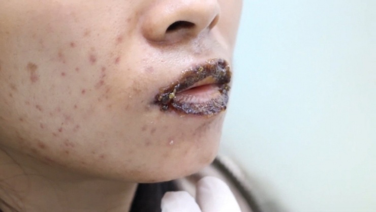 Dồn dập tai biến cao điểm làm đẹp ‘cấp tốc’ mùa Tết - 2