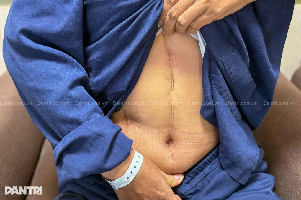 Mẹ ung thư mong được giúp đỡ sớm phẫu thuật để về chăm con trai tự kỷ - 5