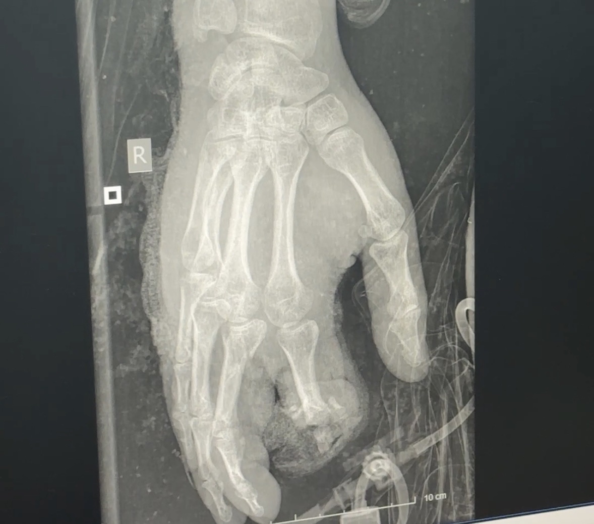 pháo nổ - Ảnh 2.