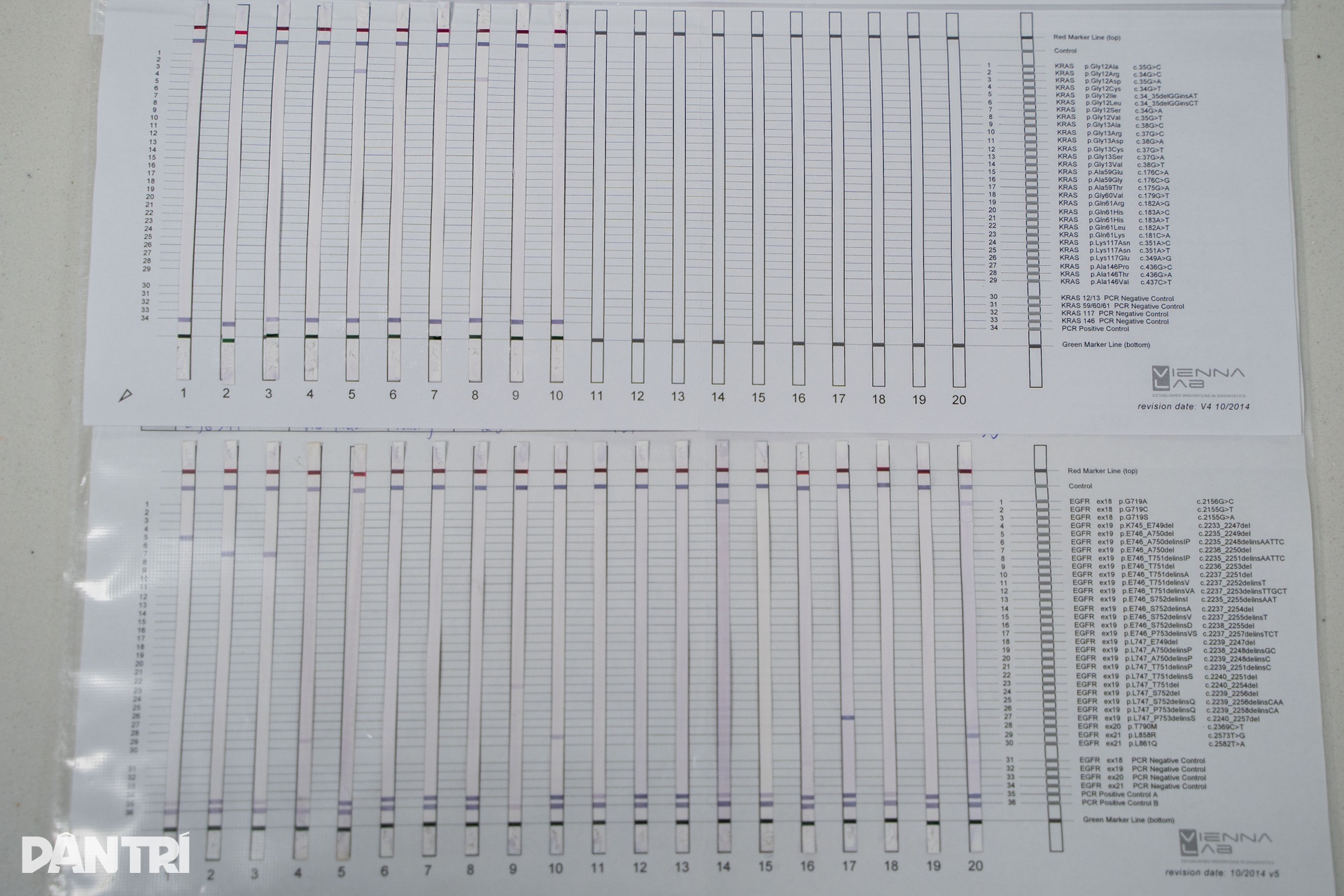 48 giờ truy tìm ADN đột biến, mở hướng điều trị đích cho bệnh nhân ung thư - 12 48 giờ truy tìm ADN đột biến, mở hướng điều trị đích cho bệnh nhân ung thư - 12