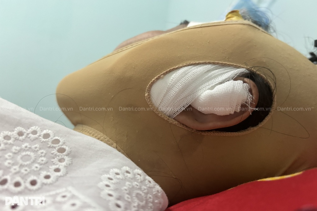 Mất hàng trăm triệu đồng, biến dạng ngực và mông nặng vì tiêm filler “lạ” - 3