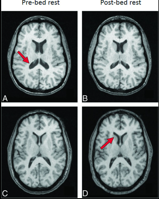 Não phi hành gia 'biến dạng' sau thời gian trên vũ trụ: Ảnh chụp hé lộ khác biệt này so với người thường- Ảnh 2.