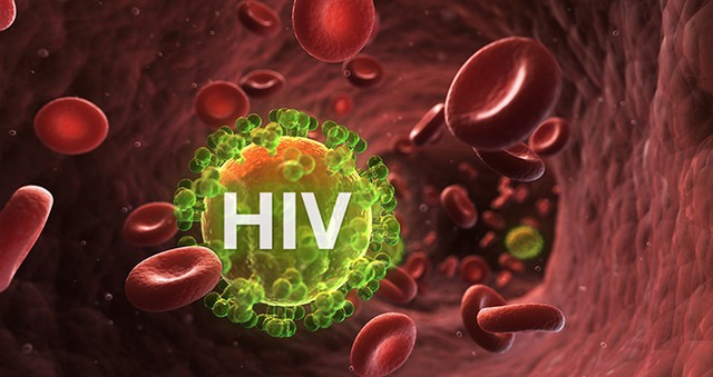 Virus HIV thúc đẩy ung thư cổ tử cung tiến triển nhanh hơn.