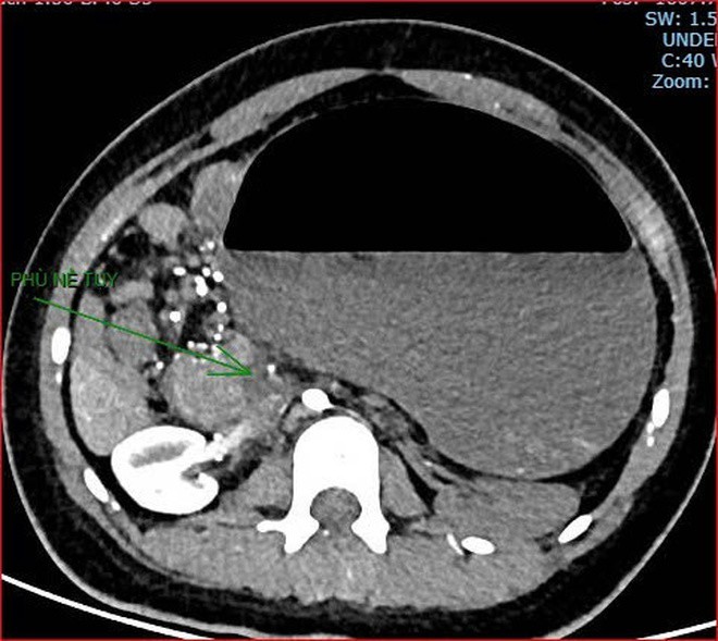 Bệnh viện Việt Nam - Cu Ba Đồng Hới phát thông cáo về ca bệnh hiếm gặp gây tử vong - 3