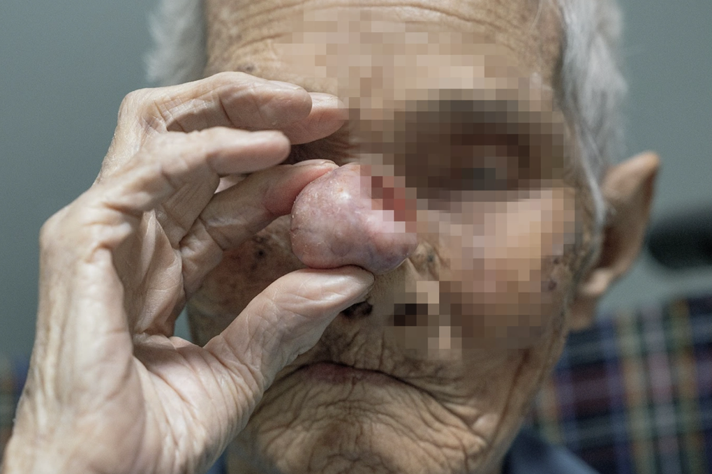 Phẫu thuật thẩm mỹ là một phần của y học tái tạo - 2