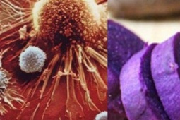 Loại củ được ví như 'thuốc bổ mùa đông', người Việt nên ăn để hỗ trợ ngăn ngừa tế bào ung thư