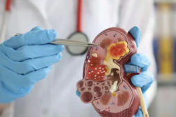 Bác sĩ cảnh báo thói quen phổ biến âm thầm gây hại thận