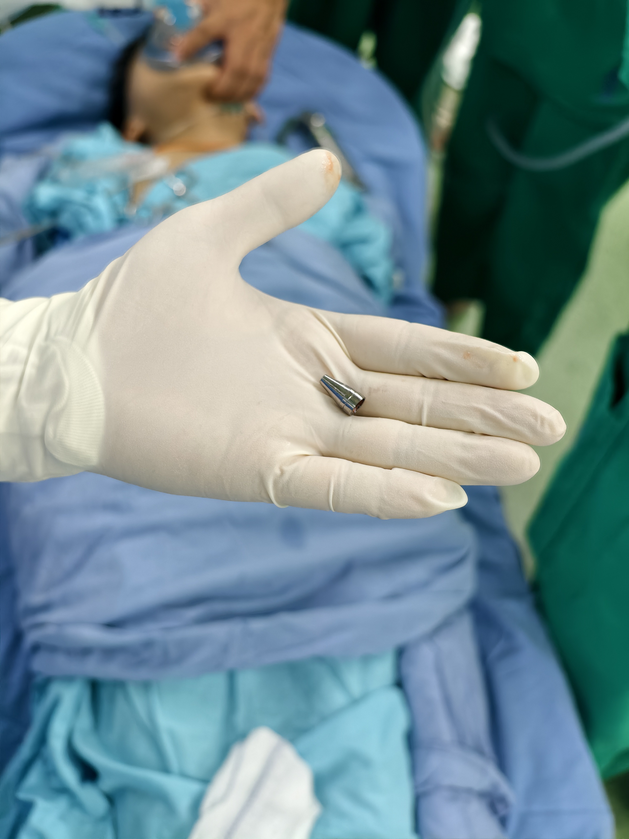 hóc đầu ngòi bút - Ảnh 2.