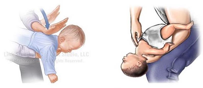 Trẻ dễ bị hóc đầu ngòi bút, nhận biết và xử trí ra sao? - Ảnh 3.