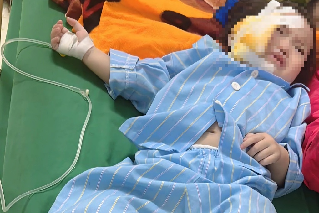 Vụ trần thạch cao sập xuống trẻ tại trường: Chưa thống nhất bồi thường - 3