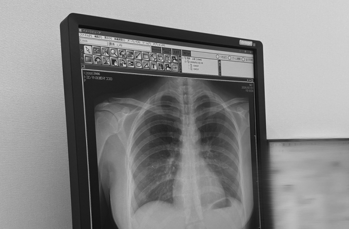 Ảnh Xquang. Nguồn: Facebook nhân vật