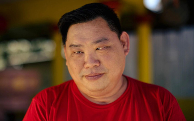 Mầm bệnh đã tấn công và gây ảnh hưởng đến thị lực của Kong Chong Wong. Ảnh: Jack Taylor