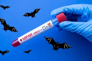 Hải Phòng ngăn ngừa dịch bệnh do virus Nipah ngay tại các cửa khẩu