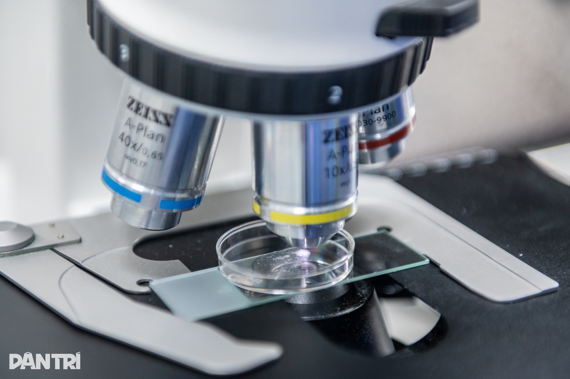 Một giờ săn lùng những tinh binh cuối cùng của người đàn ông 10 năm vô sinh - 4