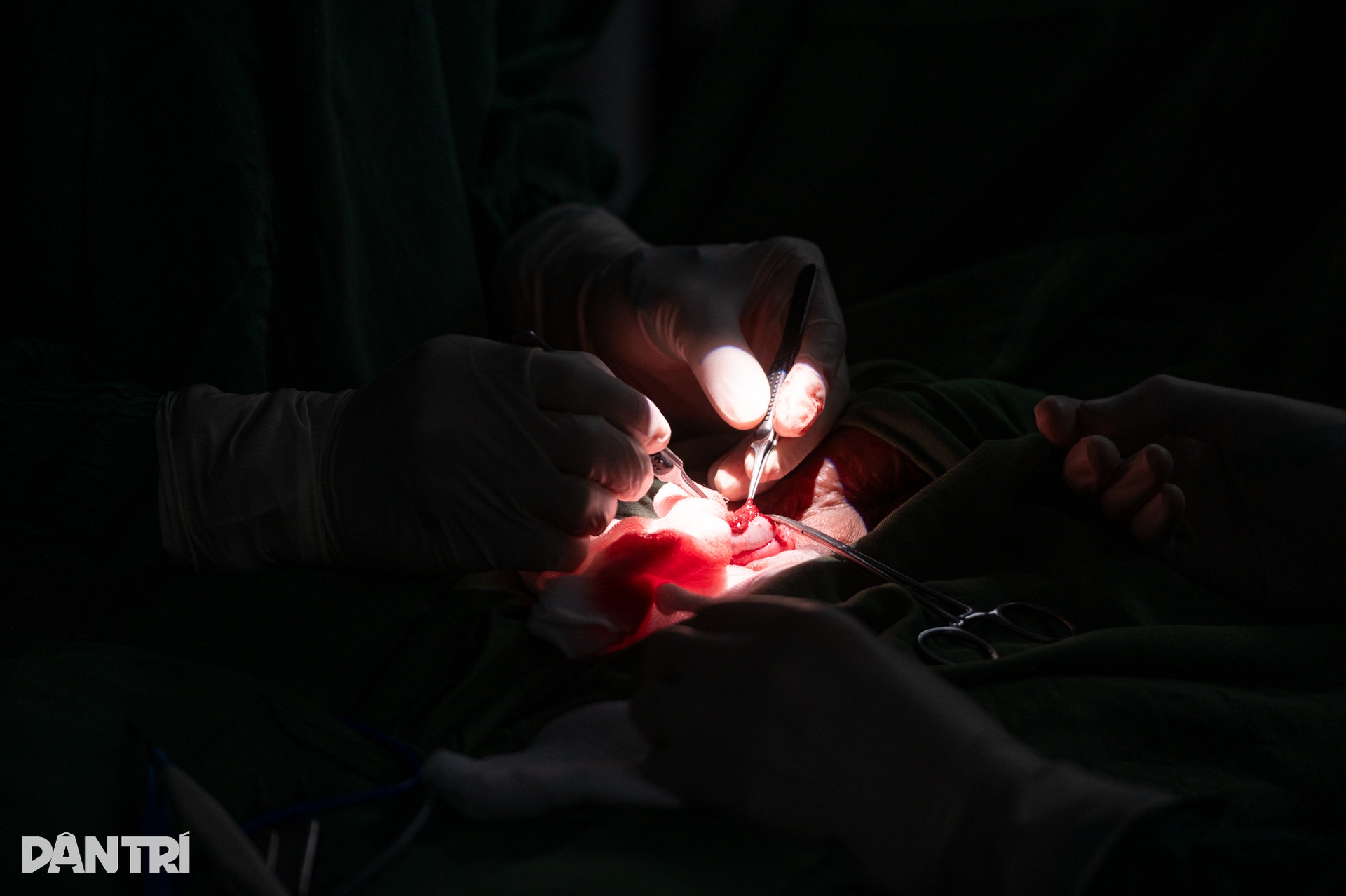 Một giờ săn lùng những tinh binh cuối cùng của người đàn ông 10 năm vô sinh - 8