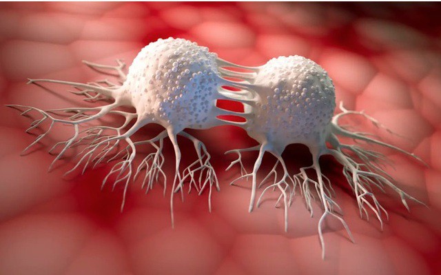 5 vị trí tế bào ung thư dễ đột nhập, người Việt nên hiểu đúng để ngừa bệnh từ sớm 1 Ảnh minh họa.