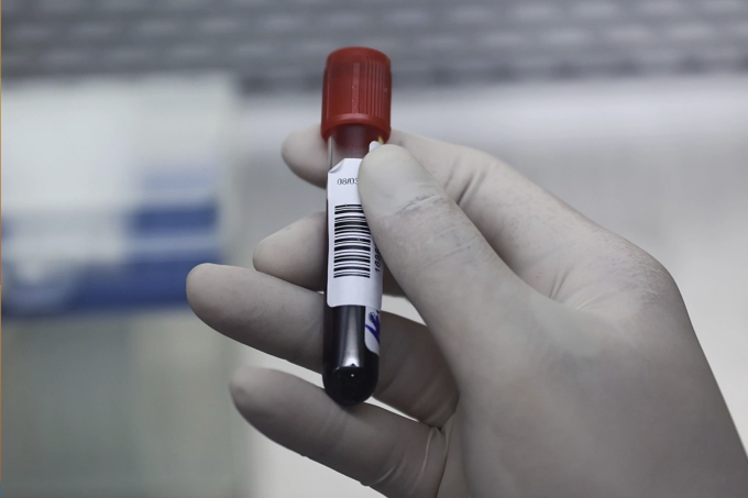 Bác sĩ lấy máu xét nghiệm cho bệnh nhân. Ảnh: Quỳnh Trần