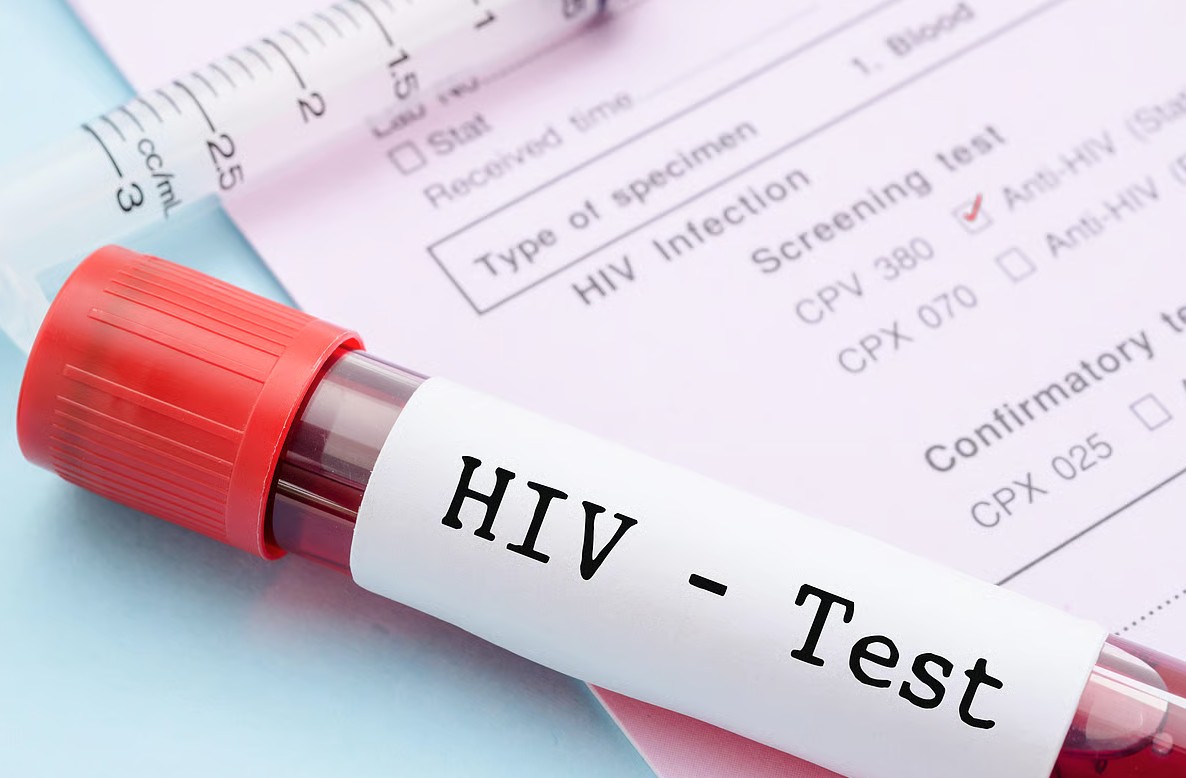 1 thành phố ghi nhận hơn 3.000 ca nhiễm HIV mới trong 9 tháng đầu năm 2025: 81% lây qua con đường này- Ảnh 1.