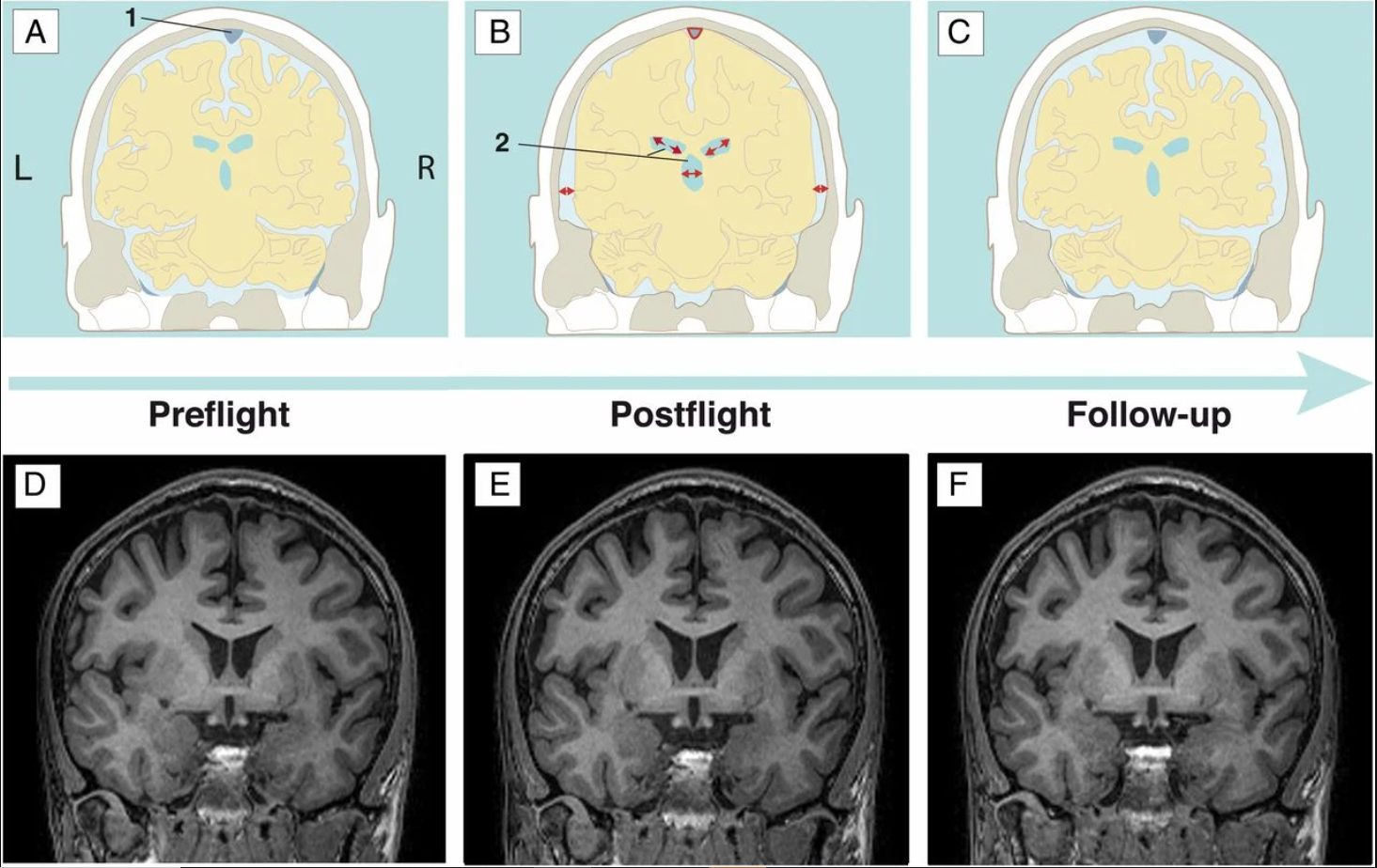 Não phi hành gia 'biến dạng' sau thời gian trên vũ trụ: Ảnh chụp hé lộ khác biệt này so với người thường- Ảnh 1.
