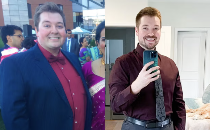 Nam bác sĩ giảm 56 kg sau 18 tháng kiên trì. Ảnh: Kevin Gendreau