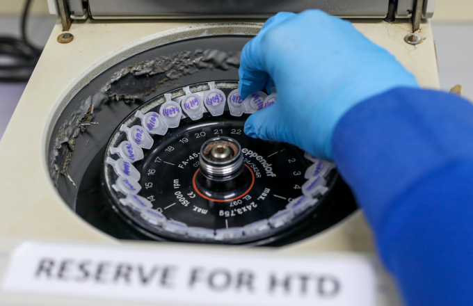 Xét nghiệm PCR các bệnh truyền nhiễm. ảnh: Quỳnh Trần