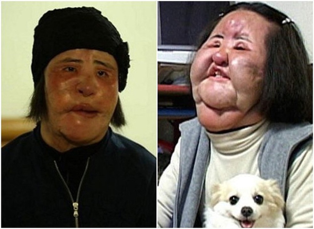 Bi kịch của biểu tượng nhan sắc Hàn hủy hoại cuộc đời vì phẫu thuật thẩm mỹ - 1