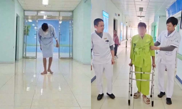 Ca mổ 10 tiếng hồi sinh cuộc đời nam thanh niên suốt 7 năm cắm đầu xuống đất 1 Nam bệnh nhân trước phẫu thuật, rất khó khăn trong di chuyển và sinh hoạt (ảnh trái) và sau ca phẫu thuật có thể nhìn thẳng về phía trước. Ảnh: BVCC.