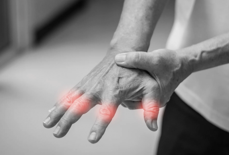 Căn bệnh phổ biến tấn công từ bên trong và thói quen âm thầm khiến bệnh nặng hơn 1 Viêm khớp dạng thấp là bệnh tự miễn dịch, xảy ra khi hệ miễn dịch tấn công nhầm lớp lót của khớp, gây viêm, sưng đau và cứng khớp kéo dài. Ảnh: Unsplash