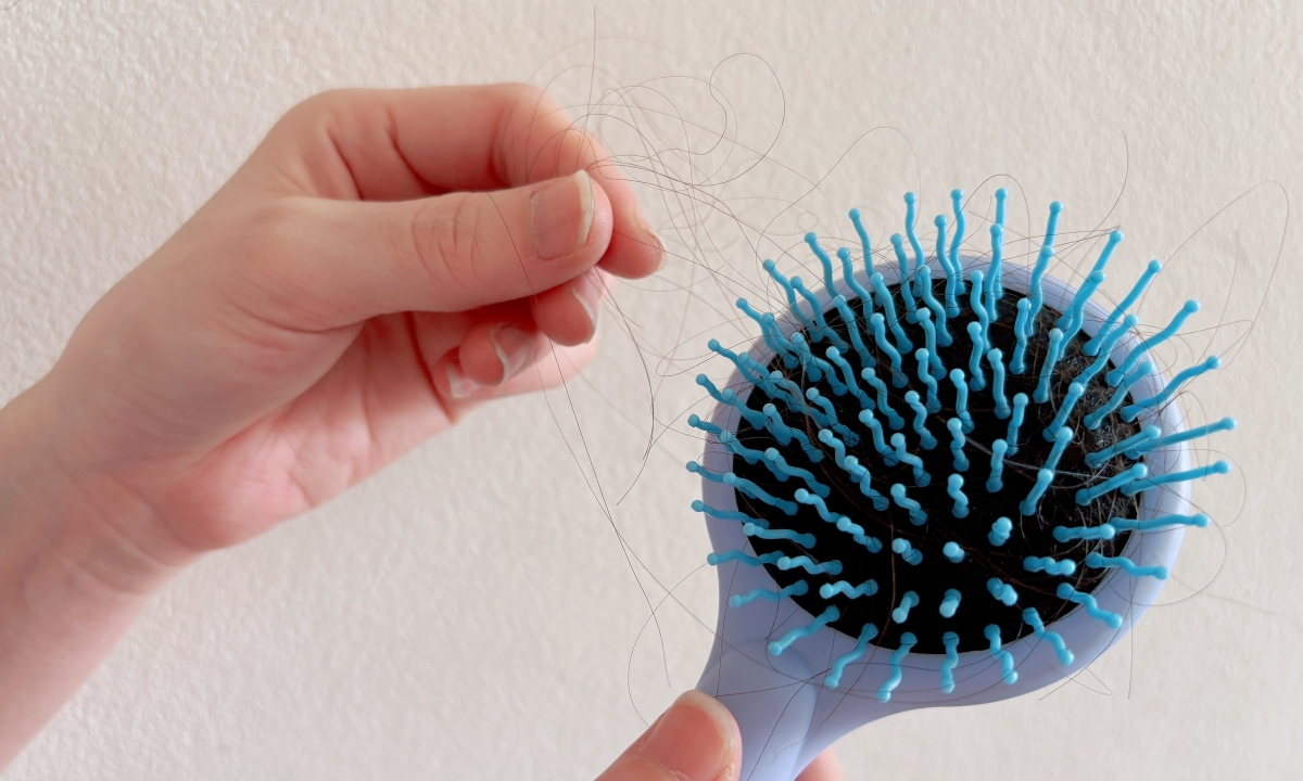 Dấu hiệu ở da và tóc cảnh báo thiếu dinh dưỡng 1 Dau hieu o da va toc canh bao thieu dinh