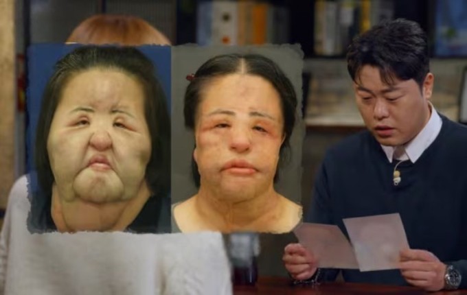 Hình ảnh gương mặt Han Hye Kyung được đài SBS tái hiện lại. Ảnh: SBS