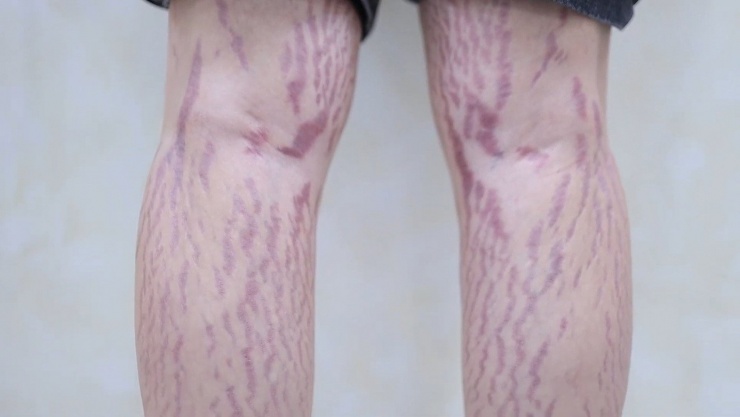 Dồn dập tai biến cao điểm làm đẹp ‘cấp tốc’ mùa Tết - 1