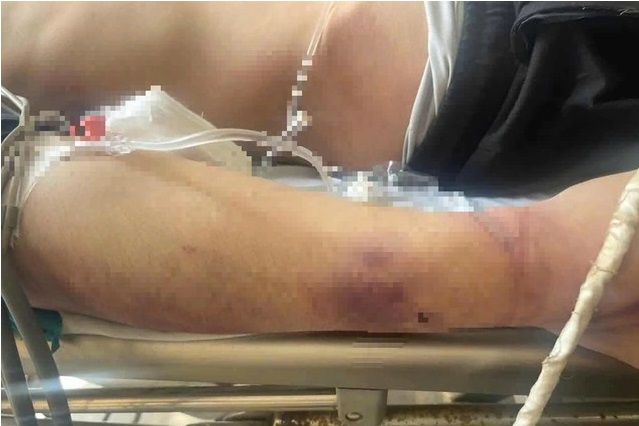 Bắt giam Giám đốc Nguyễn Văn Hải: Hành động bất thường của Trung tâm CTXH Hải Hà sau khi học viên tử vong- Ảnh 2.