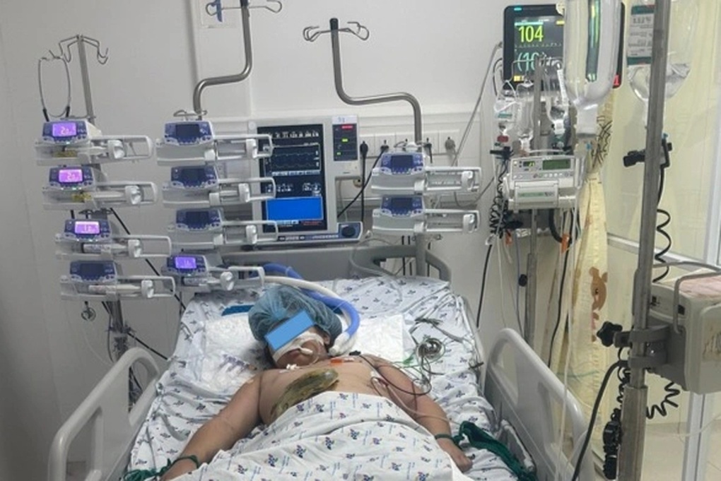 Hành trình 6 tháng cứu bé gái lóc da hiếm gặp do tai nạn giao thông - 1