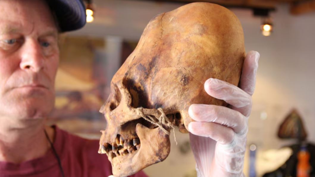Giải mã sọ Paracas: Kết quả ADN sơ bộ hé lộ khác biệt gây chấn động với hộp sọ người hiện đại- Ảnh 1.