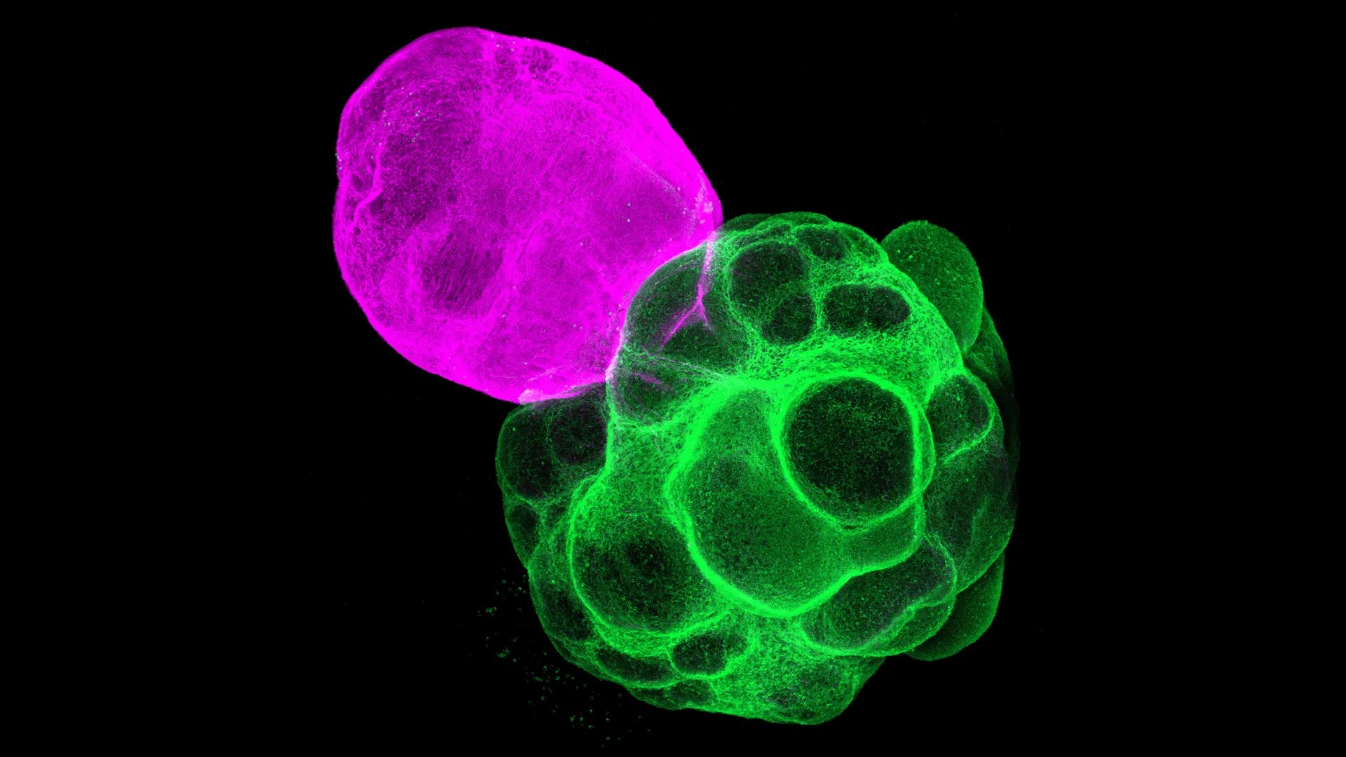 Lần đầu tái tạo được mạch não người trong phòng thí nghiệm 1 não - Ảnh 1.