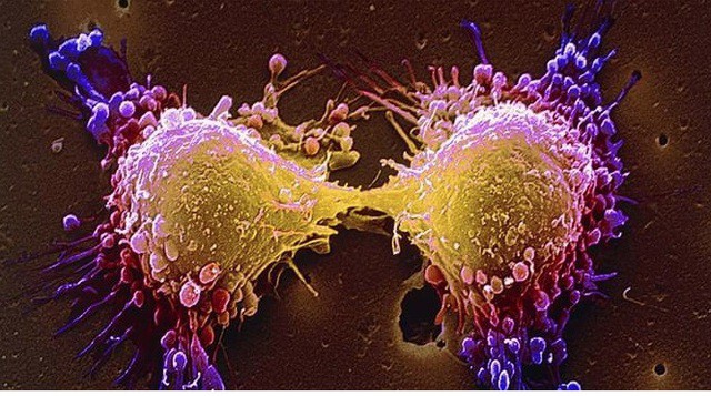 Món ăn thơm ngon khoái khẩu ngày lạnh nhưng tiềm ẩn tế bào ung thư, người Việt nên biết để tránh 1 Ảnh minh họa.