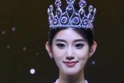 Hoa hậu Hoàn vũ Trung Quốc bị chê