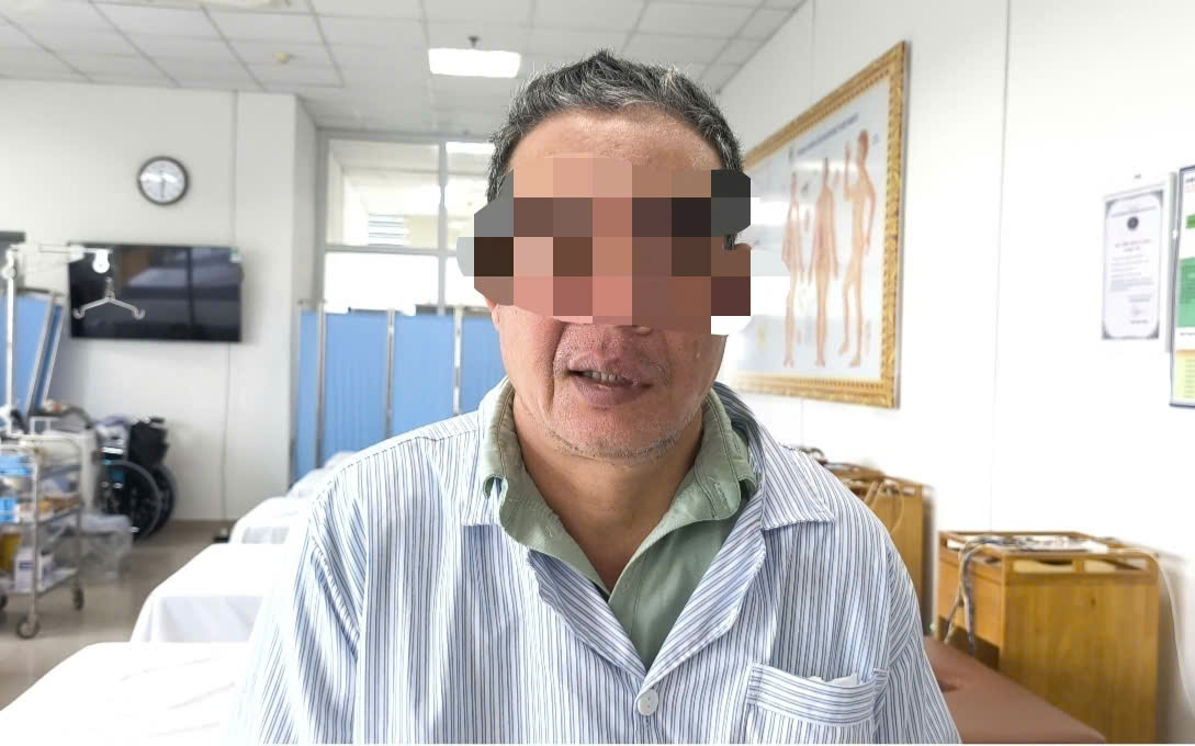 méo miệng - Ảnh 1.