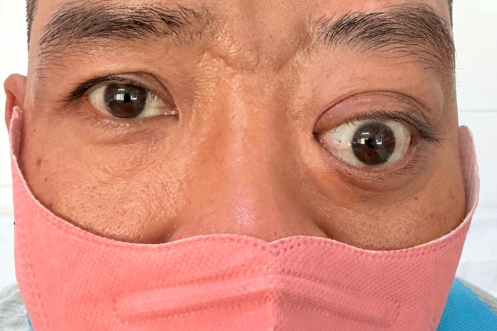 TPHCM: Bệnh nhân từ chối phẫu thuật, đòi về vì “lồi mắt sao lại mổ xoang” - 1