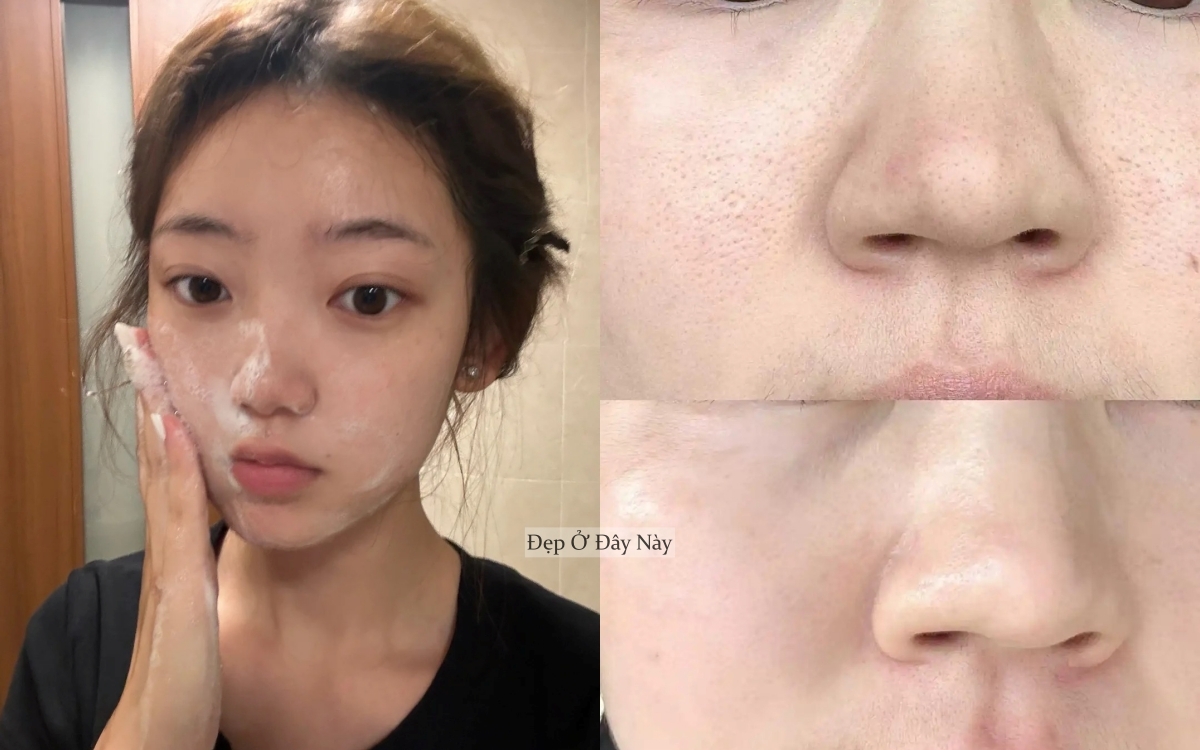 Thu nhỏ lỗ chân lông với 5 loại sữa rửa mặt làm sạch sâu mà không gây khô da- Ảnh 1.