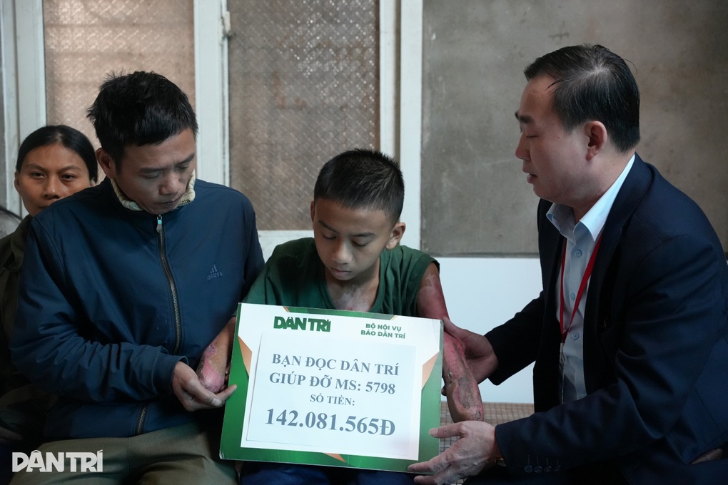 Trao hơn 142 triệu đồng tới nam sinh 14 tuổi bị điện giật phải cắt 2 tay - 1