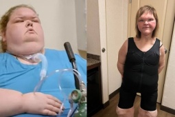 Người phụ nữ giảm 226 kg, lột xác ngoạn mục sau cắt bỏ da thừa